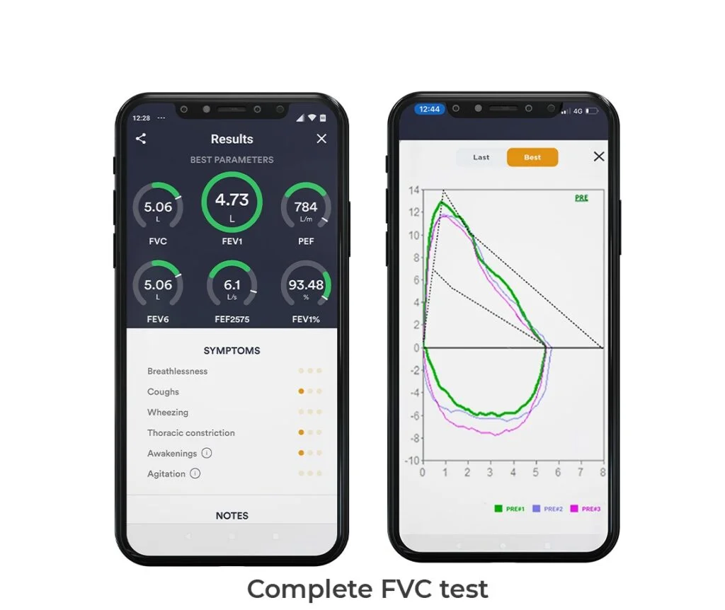 Espirômetro baseado em App
