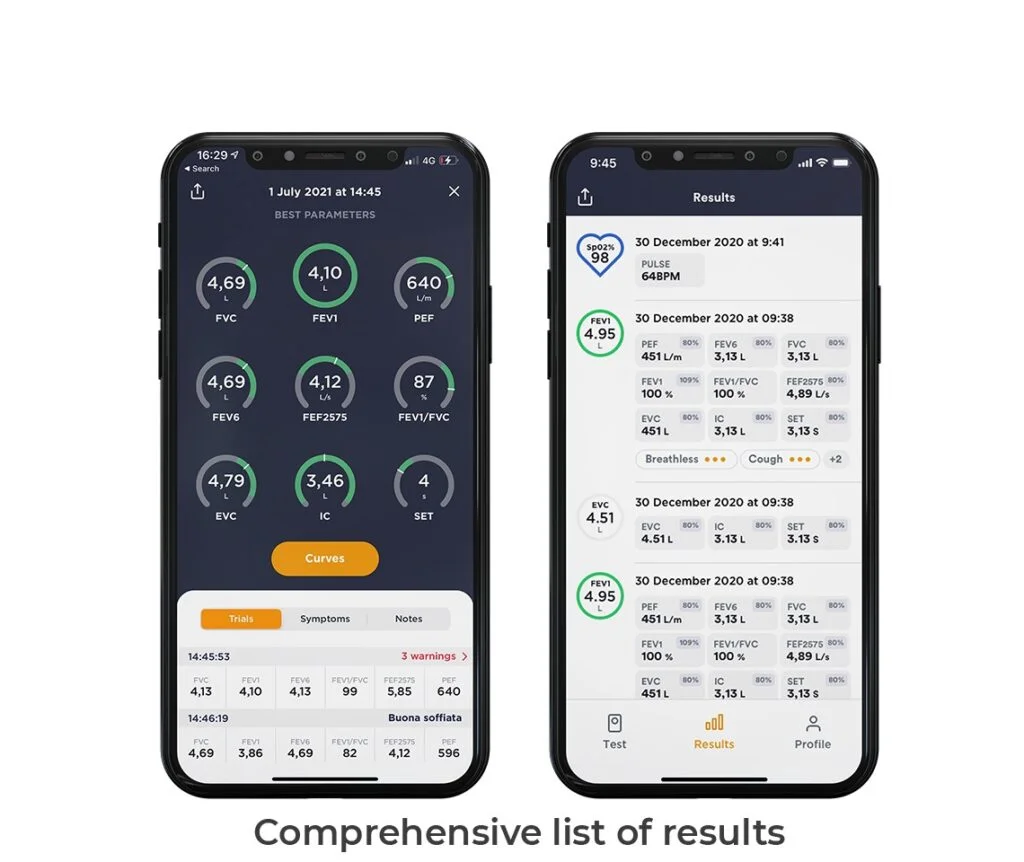 Espirômetro baseado em App